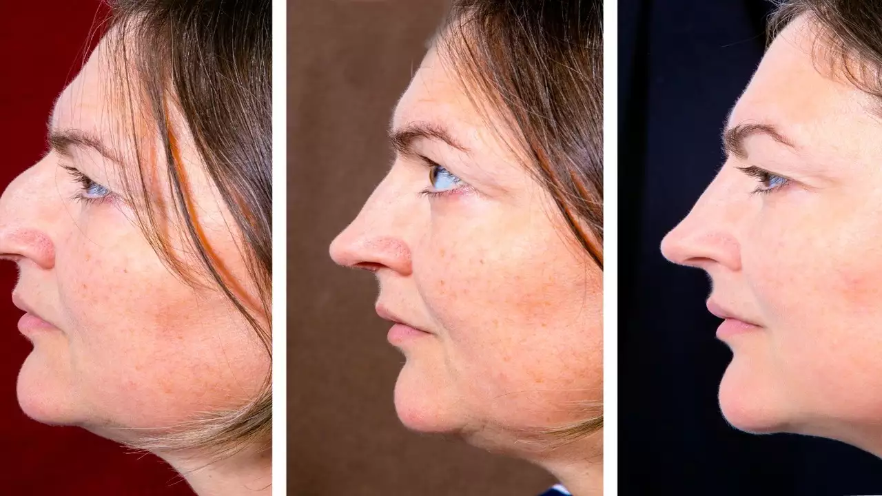 5 Amazing Tips On How To Get Rid Of Double Chin