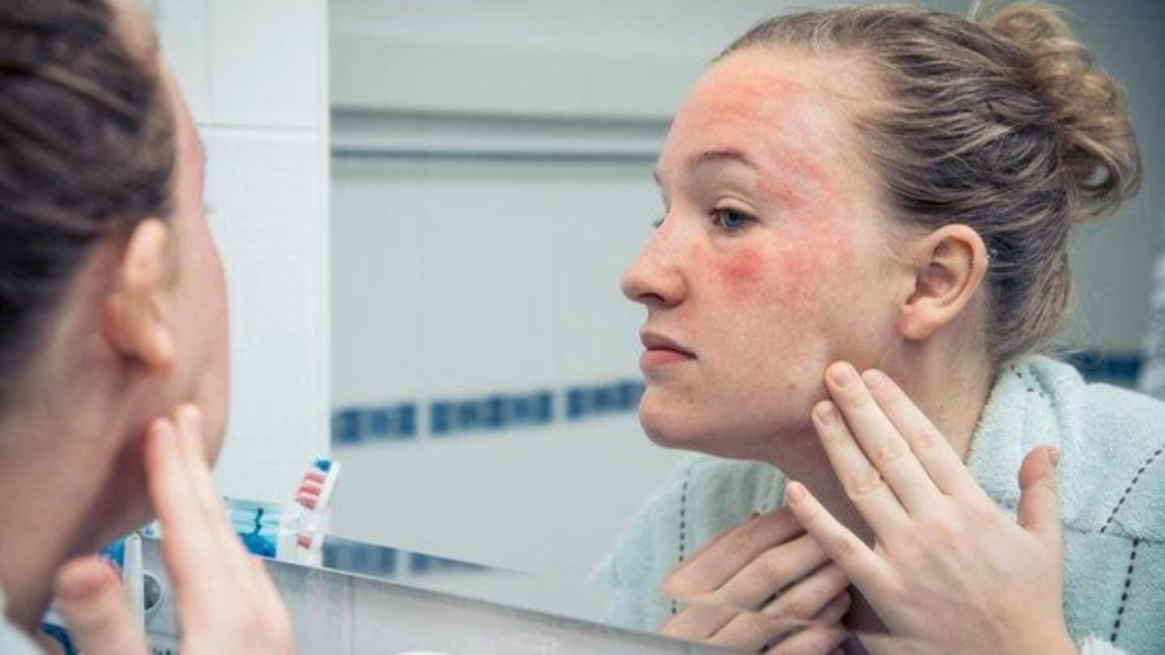 8 Common Skin Rash Names You Should Be Aware